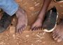 Zimbabwe Toes For Cash