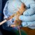 Nigeria Centre for Disease Control Intensifies Response to On   Going Lassa Fever Outbreak