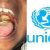 Diphtheria Claims 453 Lives In Nigeria As UNICEF Urges Urgent Vaccination
